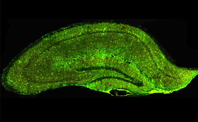 Image of a mouse hippocampus
